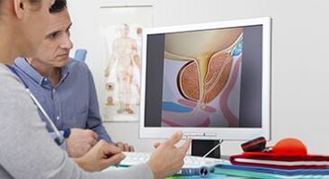 dijagnosticirati prostatitis kod muškaraca