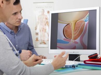 Urolog savjetuje pacijenta o prostatitisu i metodama njegovog liječenja.